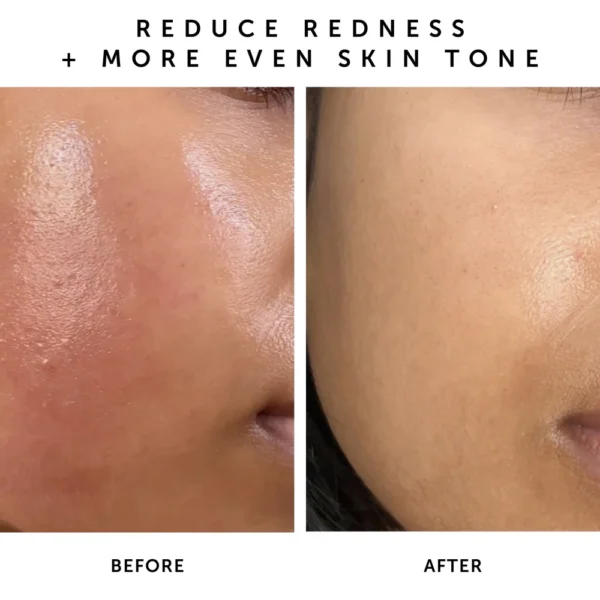 NOVA 15% Vitamin C + Turmeric Brightening Serum - Image 4